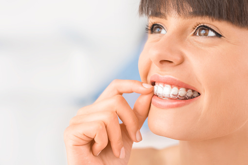 Beautiful woman with Invisalign clear aligners from Lakewood Dental Arts in Lakewood, CA Beautiful woman with Invisalign clear aligners from Lakewood Dental Arts in Lakewood, CA