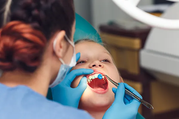 Dental professional placing fluoride in a child's mouth.